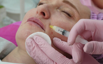 Les alternatives naturelles au botox