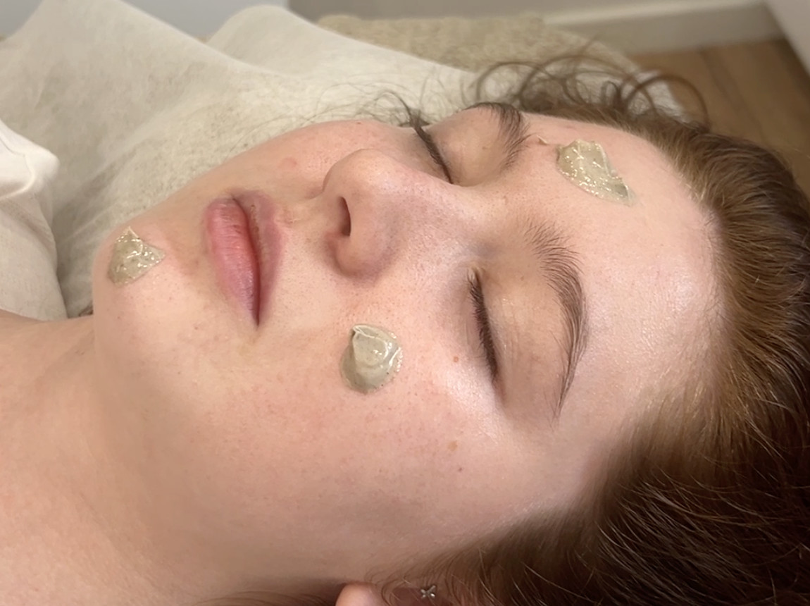 Gros plan sur un visage de femme avec des noisettes de masque sur la joue, le front et le menton